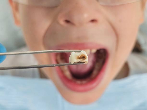 Best Emergency Pediatric Dental Care in San Leandro, CA